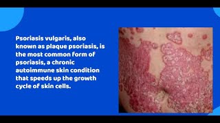 Psoriasis Vulgaris nclex rn nursing medical nursingfoundation autoimmunedisease psoriasis [upl. by Pirnot922]