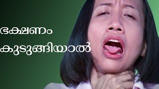 തൊണ്ടയിൽ കുടുങ്ങിയാൽ ഇത്രേ ഉള്ളു കാര്യം Choking [upl. by Elorac]