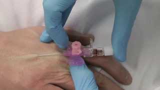 Cannulation How to gain IV access [upl. by Jessee]