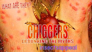 What the HECK is a Chigger  BUG Questions [upl. by Edithe]