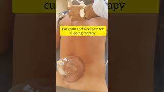 Back pain treatment backpaintreatment cuppingtherapy viralshorts viralvideo health [upl. by Wooster]