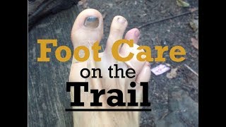 How to Prevent Blisters amp Foot Injuries on the Trail [upl. by Ailemaj]