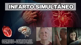 Infarto simultáneo cardiocerebral [upl. by Dihaz]