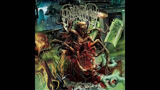 Epicardiectomy  Putreseminal Morphodysplastic Virulency Full Album [upl. by Thurston]