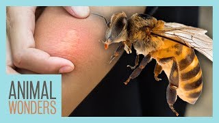 What You Need To Know About Bee Stings [upl. by Elrahc]