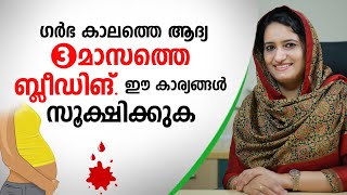 ഗർഭ കാലത്തെ ആദ്യ 3 മാസത്തെ ബ്ലീഡിങ് ഈ കാര്യങ്ങൾ സൂക്ഷിക്കുക  Pregnancy Bleeding Malayalam [upl. by Ahsein]