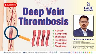 Deep Vein Thrombosis DVT  Causes Symptoms Risk Factors Diagnosis Prevention And Treatment [upl. by Thomasa]