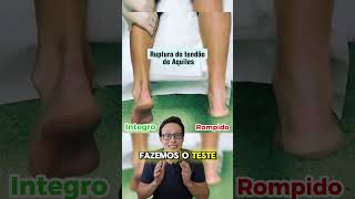 Ruptura do Tendão de Aquiles😱🦵 medico medicina curiosidades curiosidademedicina enfermeira [upl. by Ardiekal]