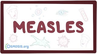 Measles  causes symptoms diagnosis treatment pathology [upl. by Asseram]