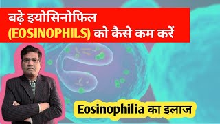 Eosinophilia का इलाज  Treatment of High Eosinophil in Blood [upl. by Kriste824]