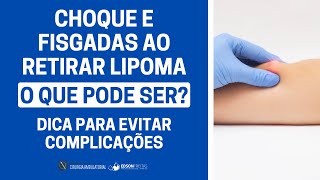 Choque e fisgadas ao retirar lipoma O QUE PODE SER Dicas para evitar complicações [upl. by Heather]