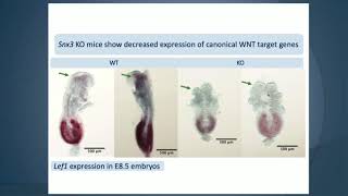 Phenotyping Embryonic Lethal Knockout mice with neural crest and neural defects  Lee Niswander [upl. by Florentia]