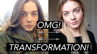 1 YEAR ESTROGEN TRANSGENDER TRANSFORMATION TIMELAPSE [upl. by Lasonde]