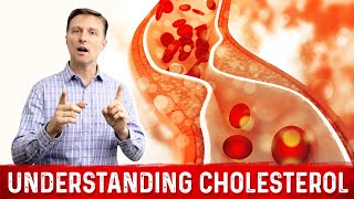 How to Read and Understand Your Cholesterol Levels [upl. by Mosier]