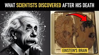 The Hidden Differences Between Einsteins Brain and a Normal Human Brain [upl. by Eniarda624]