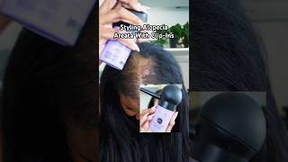 Styling My Alopecia Areata With ClipIns alopecia hairloss beauty [upl. by Sivram]