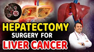 Liver Cancer Hepatectomy Surgery  Cancer  Liver  Liver cancer treatment  DrSatish  Kaizen [upl. by Entsirhc]