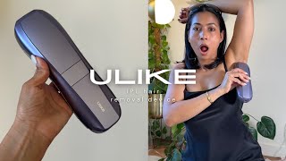 IPL Hair Removal Device on BrownDarker skin  ULIKE Air 10 [upl. by Tonina]