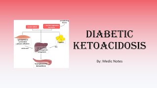 Diabetic ketoacidosis  causes signs and symptoms diagnostic criteria investigations treatment [upl. by Schuster]