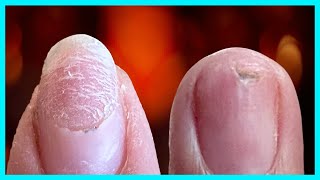 🛑STOP DAMAGING Your Natural Nails TRY My Proven Technique [upl. by Harshman]