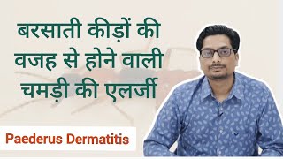 बरसाती कीड़ों की वजह से होने वाली चमड़ी की एलर्जी  Paederus Dermatitis  Blister Beetle Dermatitis [upl. by Eelan773]