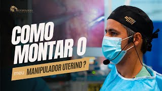 Como montar o meu manipulador uterino [upl. by Nadeau993]