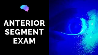 Anterior Segment Examination of the Eye  OSCE Guide  UKMLA  CPSA [upl. by Llenna]