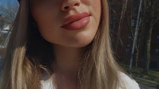 Botox lip flip stuff you have to know lip filler בוטוקס בשפתיים [upl. by Avram]