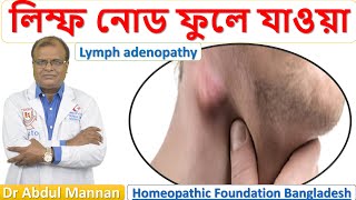 লিম্ফ এডিনোপ্যাথি। লিম্ফ নোড ফুলে যাওয়া । Lymph adenopathy ।হোমিওপ্যাথিক চিকিৎসা । Dr Abdul Mannan [upl. by Cusack]