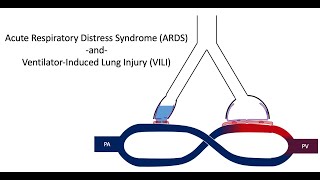 ARDS and VILI rushed for COVID19 [upl. by Latouche664]