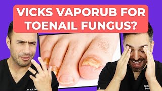 Ointment To CURE Toenail Fungus  Doctorly Investigates [upl. by Cutty]