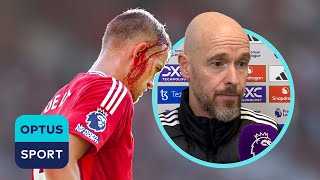 Why should he have to go off  Erik ten Hag upset with setback around De Ligt head injury [upl. by Gschu304]