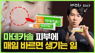 마데카솔 정말 피부 좋아지는 데 효과가 있을까ㅣ10년차 의사가 알려드립니다 마데카솔 케어 마데카솔 겔 마데카솔 분말 관리법의 효과가 궁금하시다면 이 영상을 꼭 확인하세요 [upl. by Norwood]