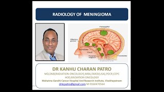 RADIOLOGY OF MENINGIOMA [upl. by Ahsenauq495]