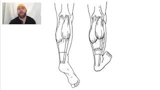 Strayer Procedure for Equinus [upl. by Nareik]