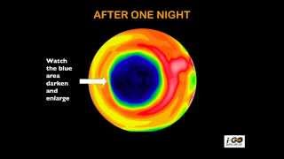 HOW DOES OVERNIGHT VISION CORRECTION WORK [upl. by Eimerej316]