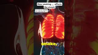 How smoking effects the alveoli lungs quitsmokingnow health [upl. by Nikos238]