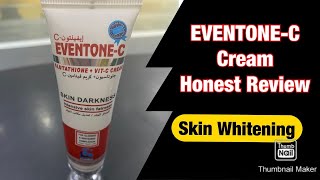 EventoneC Cream 9 Months Honest ReviewSkin Whitening Cream [upl. by Lledra]