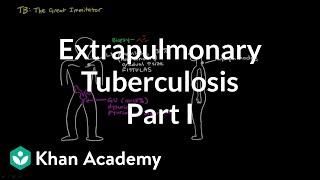 Extrapulmonary TB part 1  Infectious diseases  NCLEXRN  Khan Academy [upl. by Neleh]