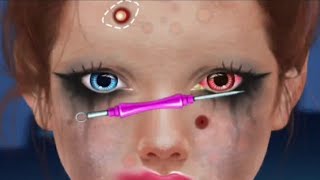 ALBINISM amp VITILIGO Makeup Animation Makeup ASMR Transformation  Homeless PRORIDER00009 [upl. by Clein]