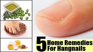 5 Effective Home Remedies to Get Rid of Hangnails  By Top 5 [upl. by Damle]