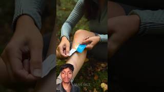 how to treat Forest injuries🥵🤯camping survival bushcraft outdoors lifehacks shorts [upl. by Perdita]