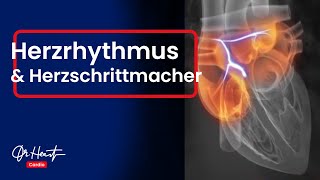 Herzrhythmusstörungen und Herzschrittmacher  Wer braucht ihn  Dr Heart [upl. by Randy]