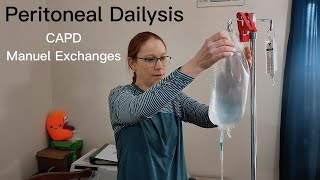 Peritoneal Dialysis PD Manual Exchanges StepbyStep Guide in 2023 [upl. by Hardy113]