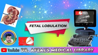 fetal lobulation of kidneys [upl. by Alor]