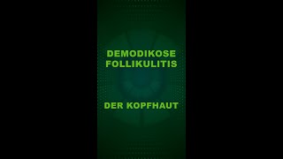 Demodikose Follikulitis der Kopfhaut [upl. by Berny]