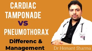 Cardiac Tamponade vs Tension Pneumothorax difference and How to do management [upl. by Nanette144]