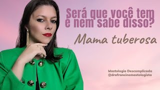 MAMA TUBEROSA  SERÁ QUE VOCÊ TEM E NEM SABE DISSO [upl. by Aronael]