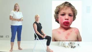 Top Tips for Anaphylaxis  First Aid [upl. by Devol]