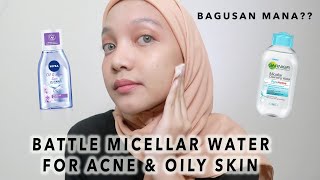 BATTLE MICELLAR WATER ACNE amp OILY SKIN NIVEA VS GARNIER MANA YANG PALING BAGUS [upl. by Limaj]